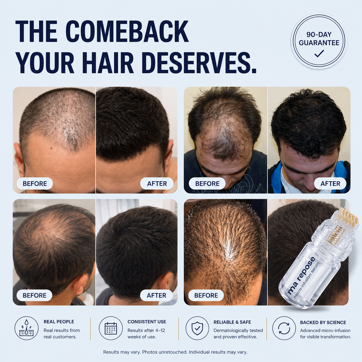 Microneedle Scalp Kit - For Thicker-Looking Hair
