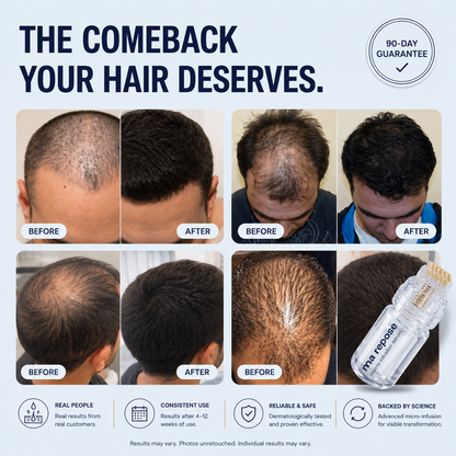 Microneedle Scalp Kit - For Thicker-Looking Hair