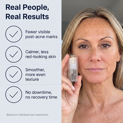 Real people, real results: fewer visible post-acne marks, calmer and less red-looking skin, smoother and more even texture, no downtime and no recovery time. Based on individual user experience.